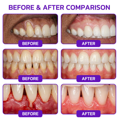 🦷𝐍𝐚𝐭𝐫𝐚𝐯𝐨𝐫® VioCore Bee Venom Gingivitis & Periodontitis Treatment Toothpaste