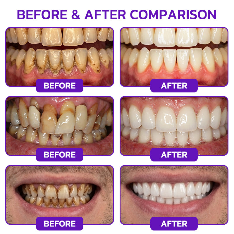 🦷𝐍𝐚𝐭𝐫𝐚𝐯𝐨𝐫® VioCore Bee Venom Gingivitis & Periodontitis Treatment Toothpaste