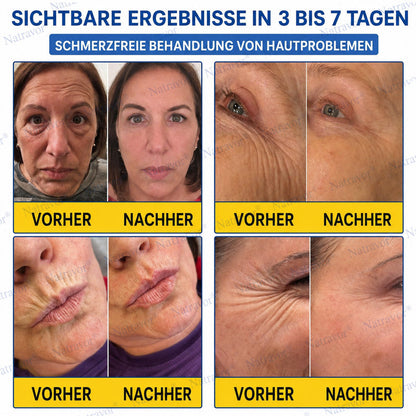 𝐍𝐚𝐭𝐫𝐚𝐯𝐨𝐫® PDRN Soin Anti-Rides – Crème Liftante et Raffermissante