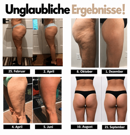 Natravor® Flex Shape Leggings-3-fache Fettverbrennung – Fett wird sogar im Sitzen verbrannt.