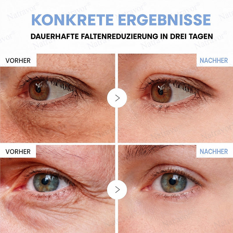 𝐍𝐚𝐭𝐫𝐚𝐯𝐨𝐫® PDRN Soin Anti-Rides – Crème Liftante et Raffermissante