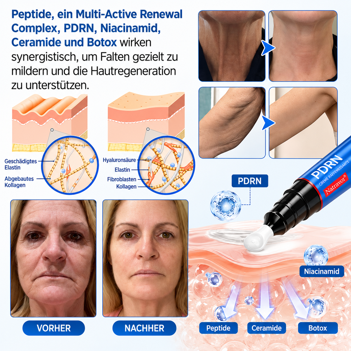𝐍𝐚𝐭𝐫𝐚𝐯𝐨𝐫® PDRN Soin Anti-Rides – Crème Liftante et Raffermissante