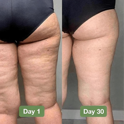 Natravor® Flex Shape Leggings-3-fache Fettverbrennung – Fett wird sogar im Sitzen verbrannt.